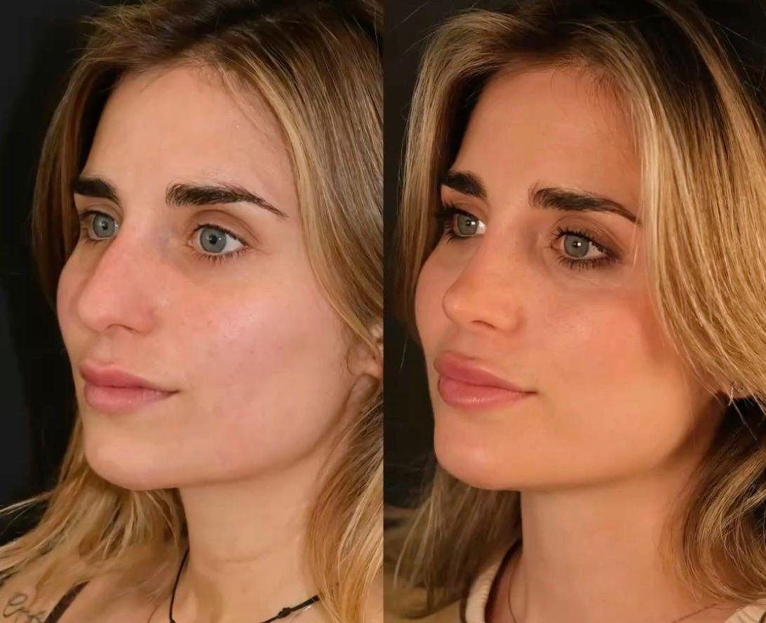 Estética facial